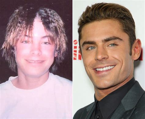 Celebrity teeth transformations - Daily Star