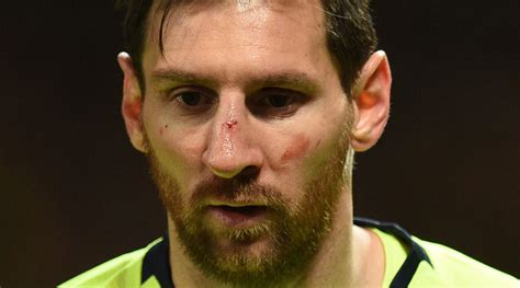 Lionel Messi: Barcelona star out vs. Huesca with facial injury - Sports ...