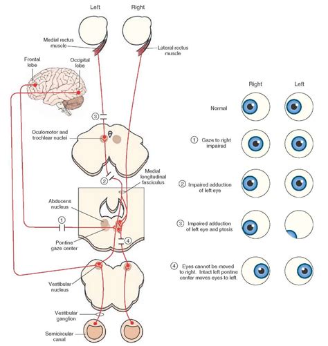 Conjugate Vertical Gaze