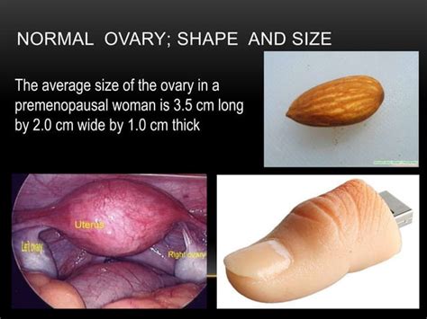 Basic gynae ultrasound