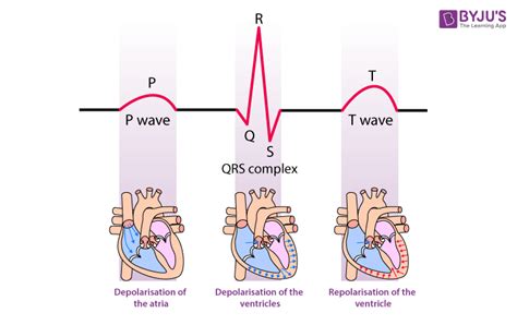 What does QRS complex represent in ECG?