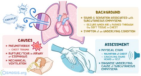 Crepitus: What Is It, Causes, How It’s Assessed, and More | Osmosis