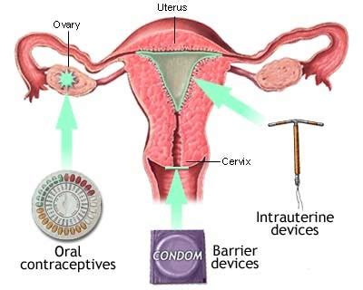 Natural Methods of Contraception