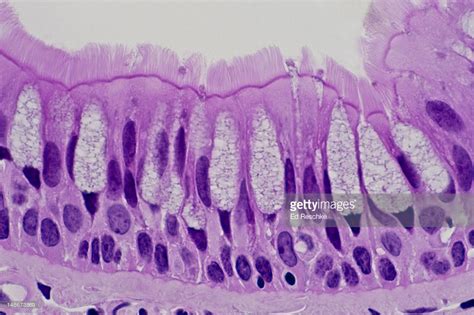 Pseudostratified Ciliated Columnar Epithelium