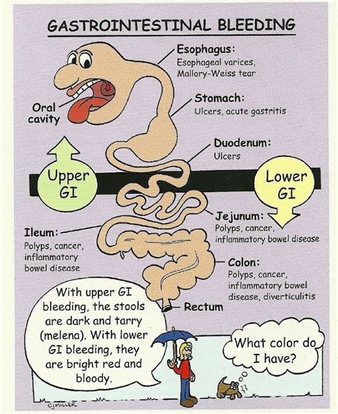 Gastrointestinal(GI) Bleeding Symptoms, Treatment, Risk Factors