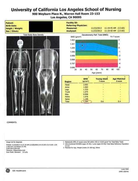 My DEXA Scan for Body Composition – BJJ Caveman