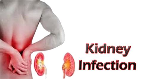 Kidney Infection - Signs, Symptoms, Causes, Treatment, Home Remedies