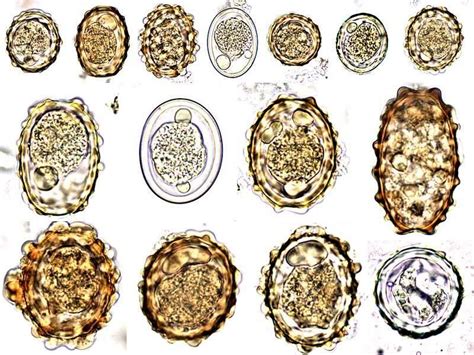 Ascaris lumbricoides egg | Medical Laboratories | Medical laboratory ...