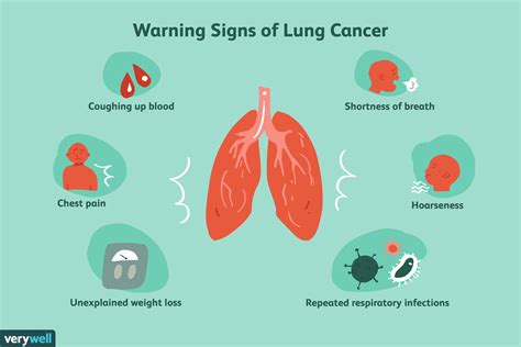 ¿Es su tos una tos de cáncer de pulmón? - Medicina Básica