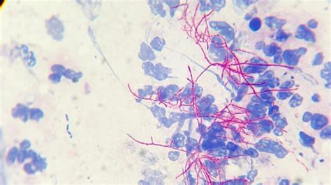 Acid Fast Staining - Pharmacy Scope