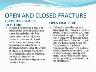 Bone fractures | PPT