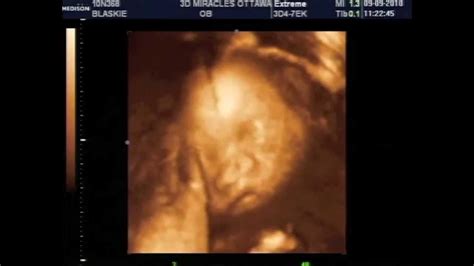 30 weeks pregnant 3d ultrasound - sayguy