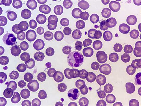 Difference Between Cell Organelles and Cell Inclusions | Compare the ...