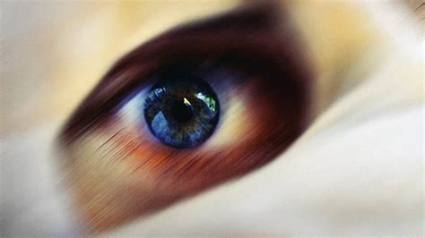 Scratched cornea vs. pink eye: Symptoms, causes, and treatment