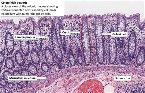 Colon – Normal Histology – NUS Pathweb :: NUS Pathweb