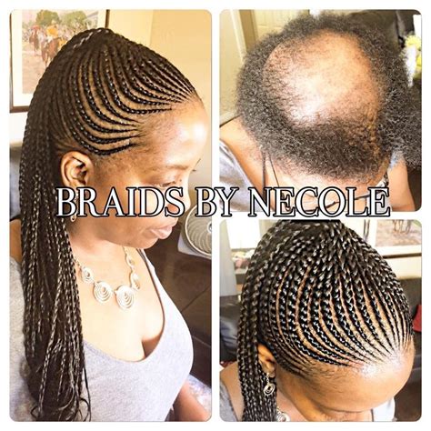 11+ Amazing Medium Length Hairstyles For Black Women To Cover Bald Spot