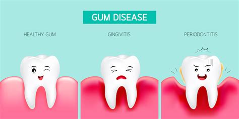 How To Restore Healthy Gums - Carpetoven2