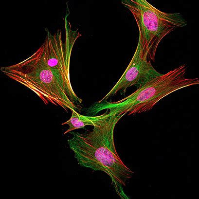 5 Tips for Immunofluorescence Cell Staining I Microscopy I ibidi Blog