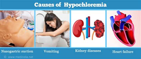 Hypochloremia - Causes, Symptoms, Diagnosis, Treatment & Prevention