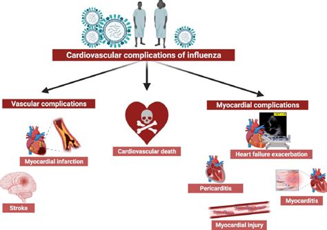 Cardiovascular complications of influenza virus. Multiple... | Download ...