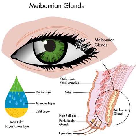 Lipiflow For Dry Eye