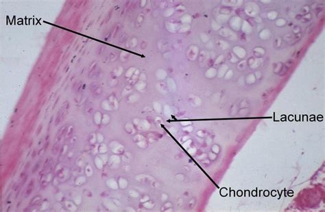 4 Human hyaline cartilage (Haematoxylin & Eosin stain) | Download ...