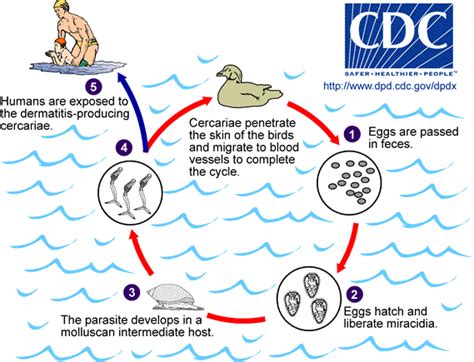 Cercarial dermatitis - WikEM