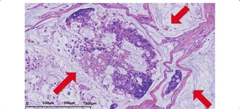 Diagrams Histology And Histophathology