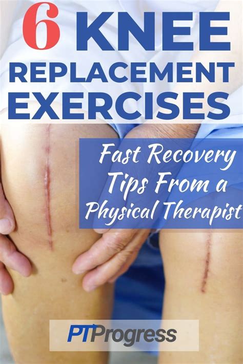 Knee Replacement Exercises To Do After Surgery | Knee replacement ...