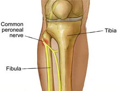 Peroneal Nerve Floss - reduce numbness in the foot or outside leg ...