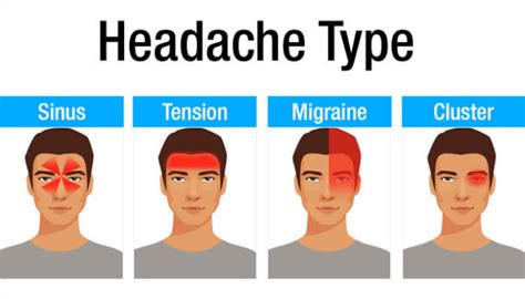 Suffering From Headaches? How Physical Therapy Can Help! - Dutch PT