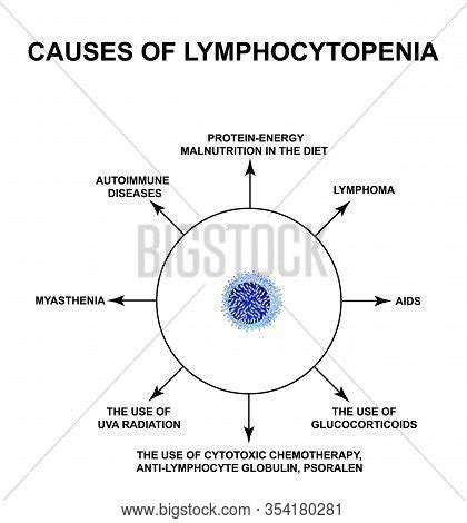 Causes Lymphocytopenia Image & Photo (Free Trial) | Bigstock