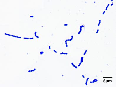 File:Gram stain of Streptococcus pyogenes.jpg - Wikimedia Commons