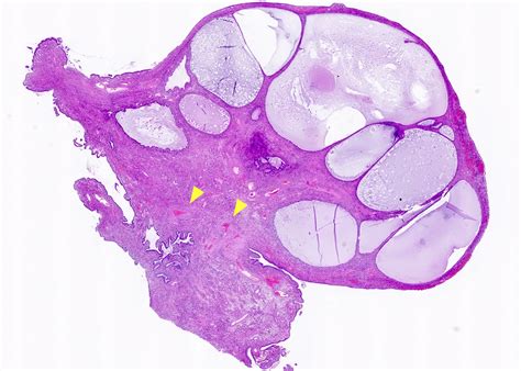 Histología Del Endocérvix