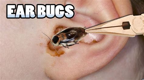 How To Remove An Insect From Your Ear