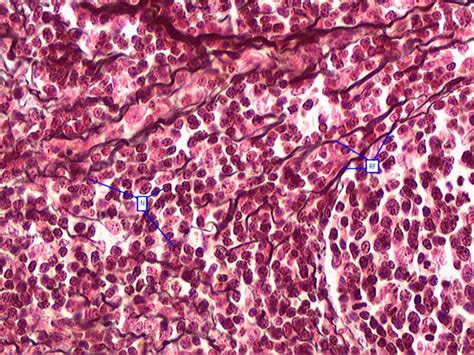 reticular connective tissue Diagram | Quizlet