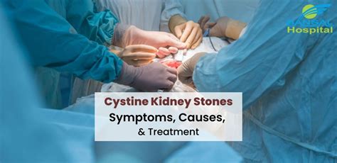 Cystine Kidney Stones: Symptoms, Causes, And Treatment