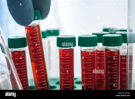 Vials of blood in lab Stock Photo - Alamy