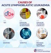 What is Acute Lymphoblastic Leukaemia (ALL)? | CFCH | Centre for ...