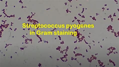 Streptococcus Pyogenes Gram Stain