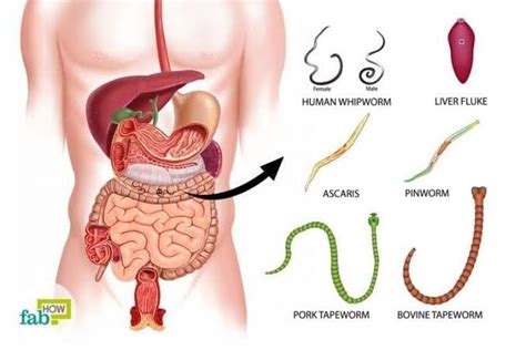 Intestinal worms, also known as parasitic worms, a