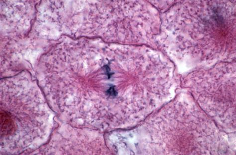 Mitosis In Animal Cell Whitefish Blastula - Mitosis in section of ...