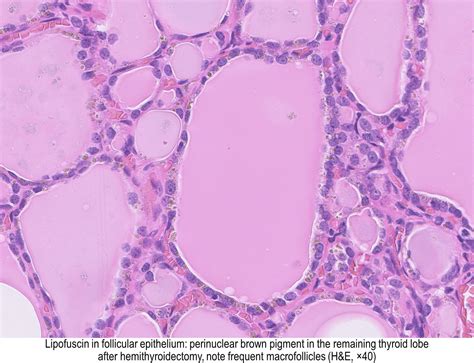 Thyroid Hormones