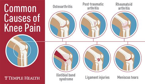 Knee Pain: When Surgery Is Needed & Other Options