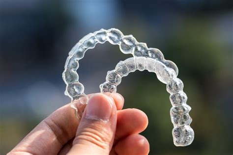 Invisalign Reviews: Invisalign - The Good, The Bad & The Ugly