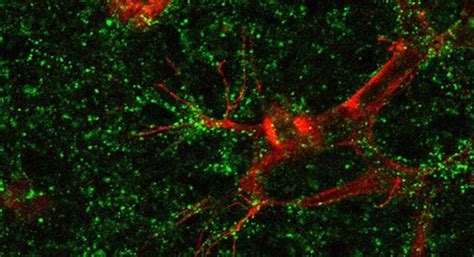 New strategy for treating common retinal diseases shows promise