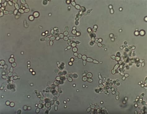 Yeast Under a Microscope – Microscope Clarity