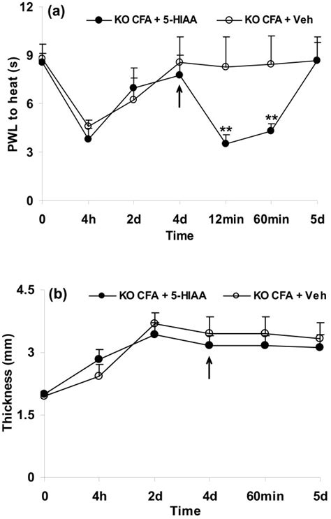 5-Hydroxyindolacetic acid (5-HIAA), a main metabolite of serotonin, is ...