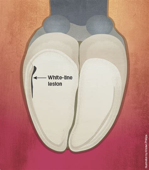 Don’t cross the line when managing white-line disease - Progressive ...