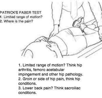 Patricks faber test is for pain in the groin and hip.